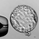 embryo